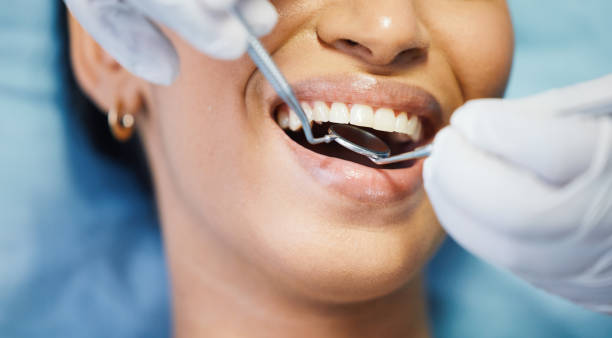 Best Knocked-Out Tooth (Avulsed Tooth) Treatment in , AZ